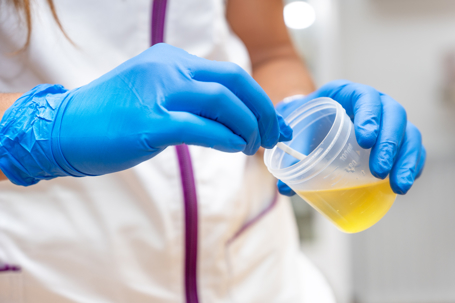 urine sample